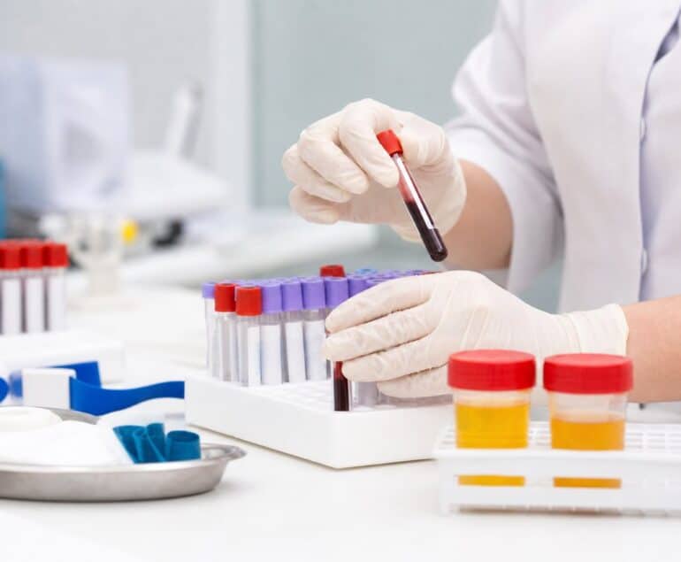 Blood and urine samples for kidney function testing in Seremban