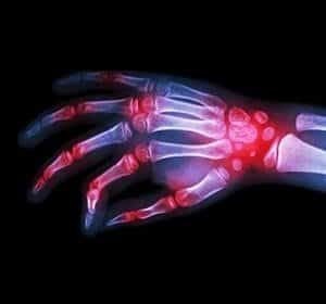 Rheumatology300x280